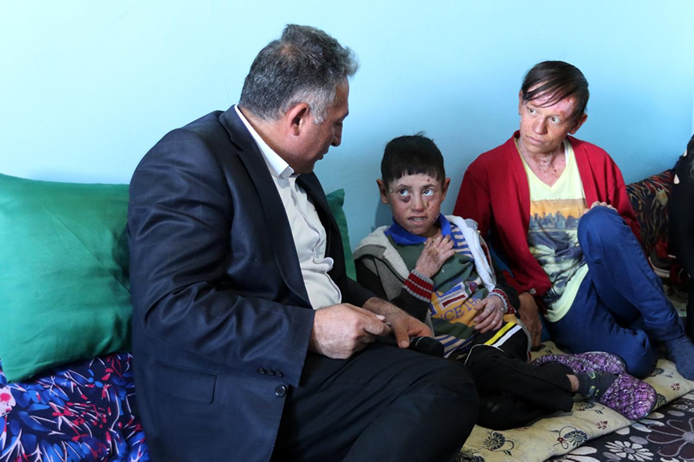 "Kelebek" hastası çocuklara yardım eli uzandı "Kelebek" hastası çocuklara yardım eli uzandı